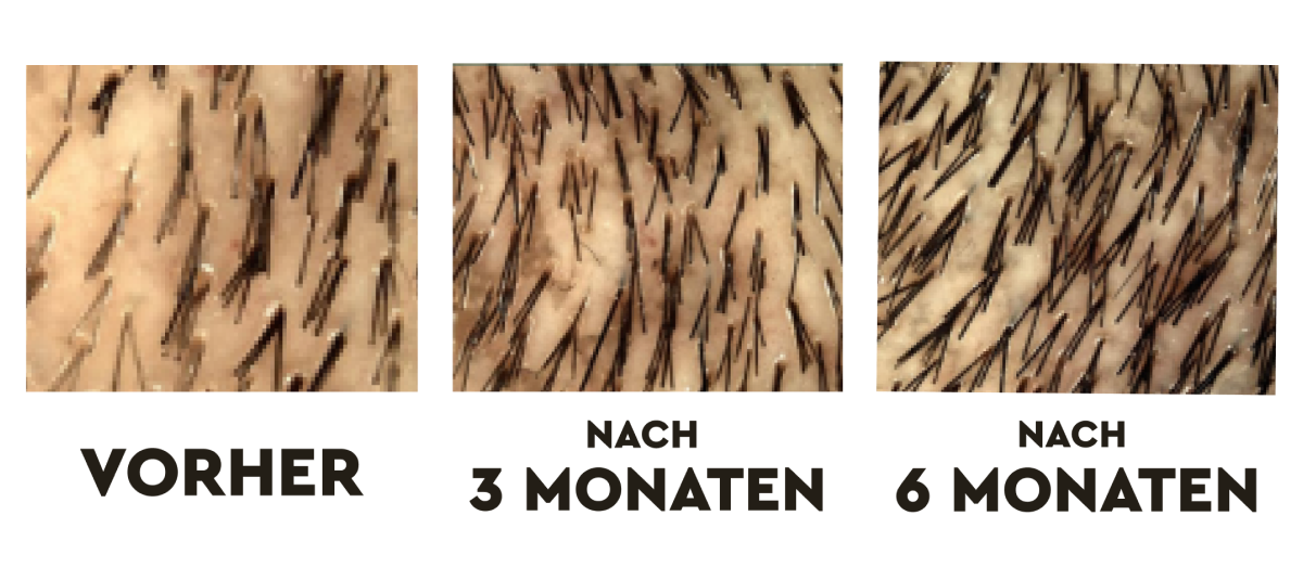 Haarwachstum DMG Clinical